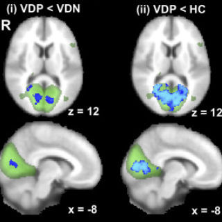 Visual Network